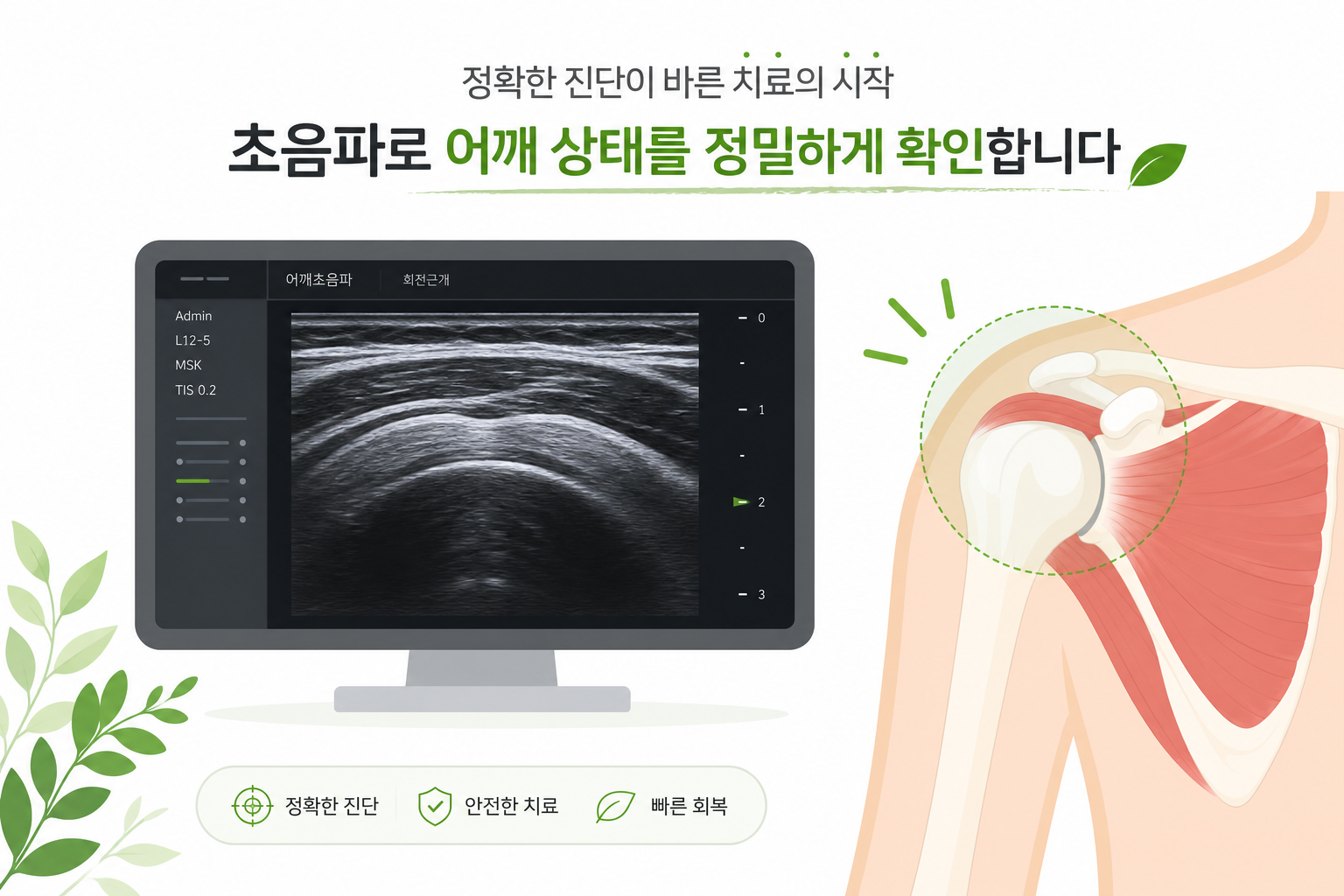 초음파 장비 화면과 어깨 부위를 함께 보여주는 개념적 일러스트 (실제 시술 장면 묘사는 지양) 액와신경 약침 치료 이미지