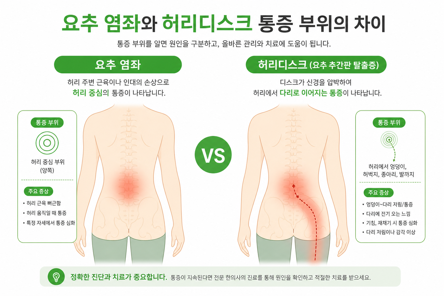 요추 염좌와 허리디스크의 통증 부위 차이를 비교하는 인체 다이어그램 허리 삐끗 디스크 이미지